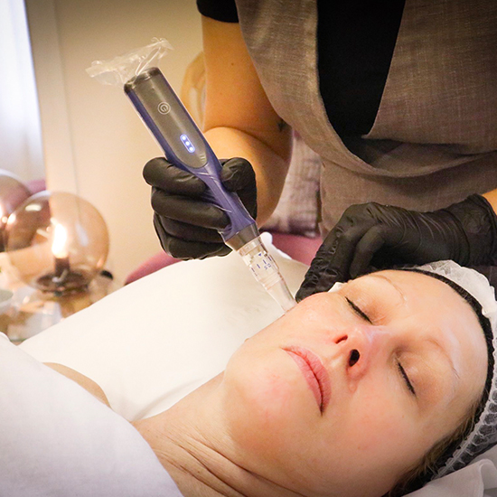skinpen1